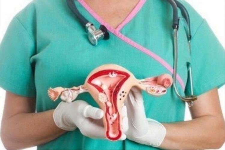 Waspada Kanker Serviks! Perempuan Diimbau Manfaatkan IVA Test Gratis di Puskesmas
